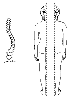 Equilibrio assiale, disequilibrio ponderale: una parte maggiore del tronco si trova a destra rispetto all'asse sagittale che passa per la spinosa di T1 e la plica interglutea