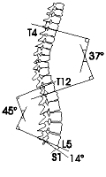 Angoli medi delle curve vertebrali sagittali